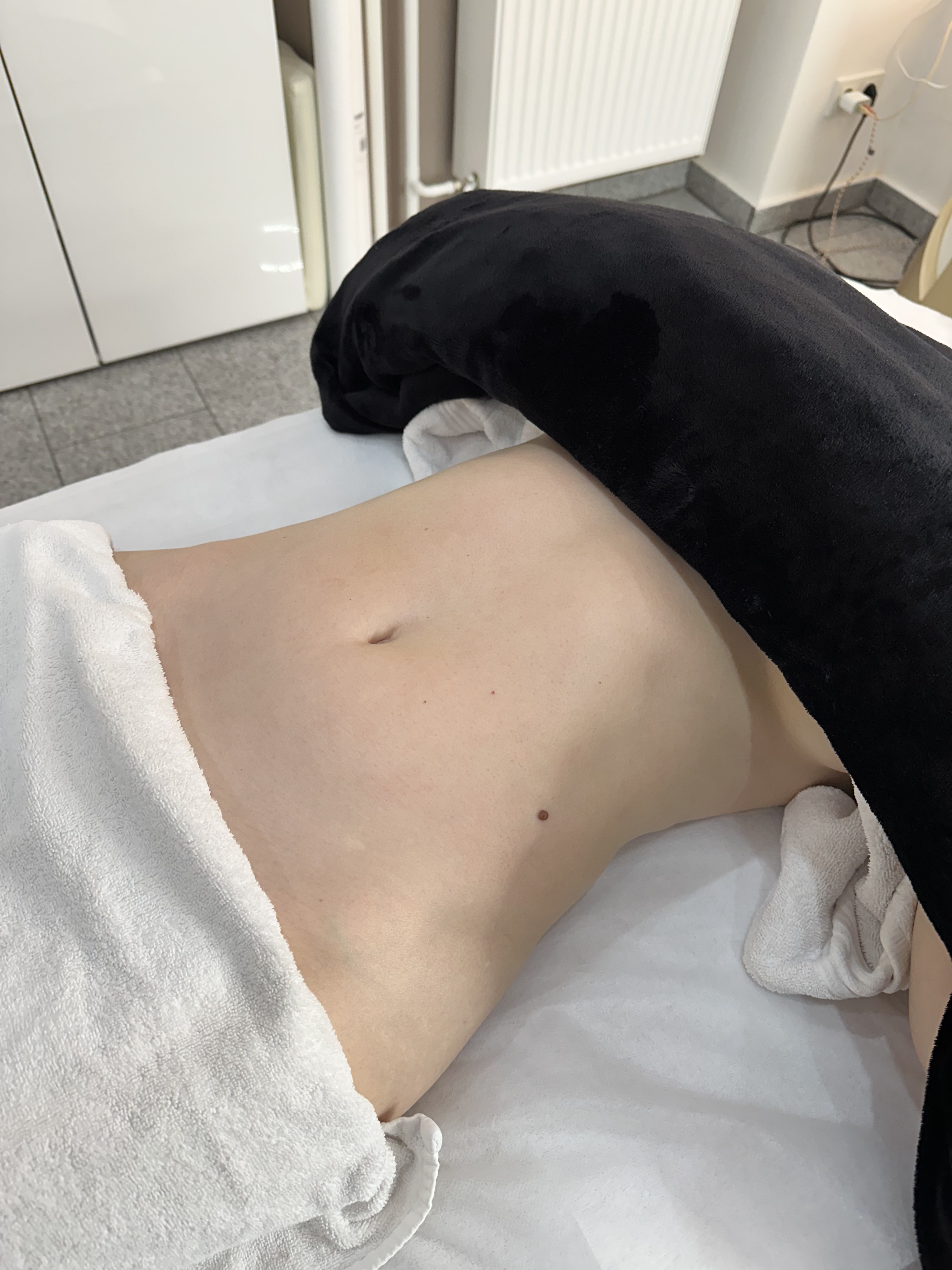 Body Sculpting bei Face Sculpt Beauty Berlin